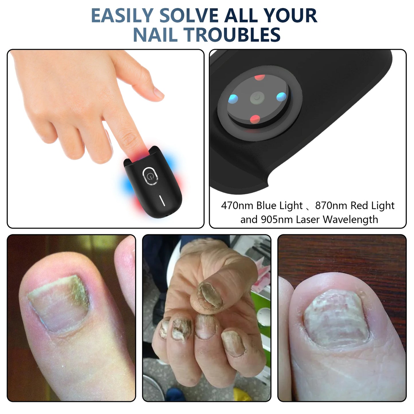 The Anti-Fungal Toenail Laser Therapy Machine with USB Charge