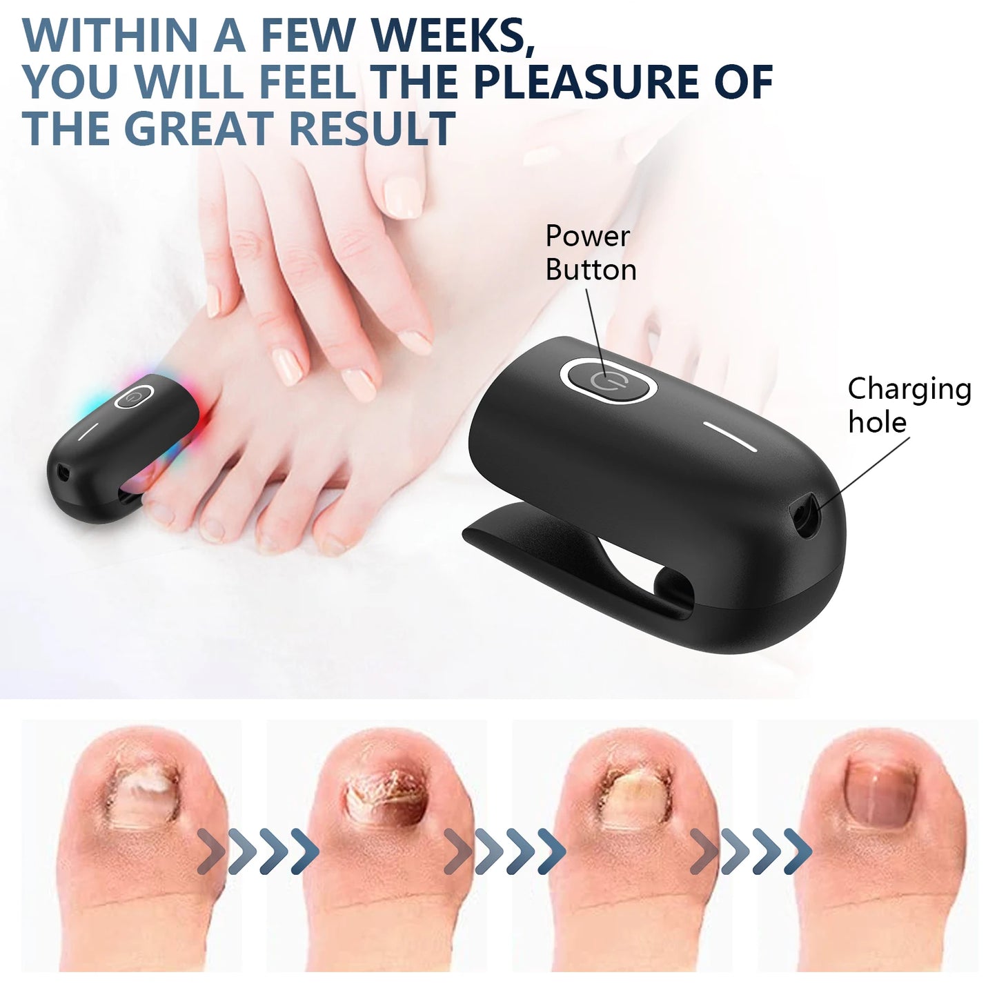 The Anti-Fungal Toenail Laser Therapy Machine with USB Charge